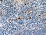 Phospho-DDR1 (Tyr513) Antibody in Immunohistochemistry (Paraffin) (IHC (P))