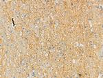 Phospho-Cdc25B (Ser151) Antibody in Immunohistochemistry (Paraffin) (IHC (P))