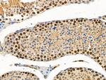 Phospho-BAP1 (Ser592) Antibody in Immunohistochemistry (Paraffin) (IHC (P))