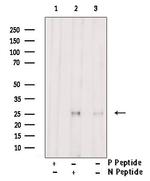 Phospho-Bim (Ser69) Polyclonal Antibody