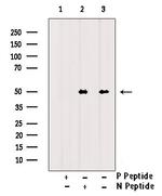 Phospho-CaMKII alpha/beta/delta (Tyr231) Polyclonal Antibody