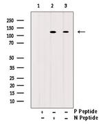 Phospho-c-Cbl (Tyr700) Polyclonal Antibody
