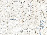Phospho-CENPA (Ser7) Antibody in Immunohistochemistry (Paraffin) (IHC (P))