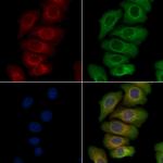 Phospho-DDR1 (Tyr513) Polyclonal Antibody