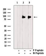 Phospho-DR6 (Ser562) Polyclonal Antibody