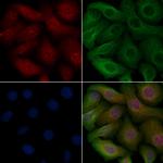 Phospho-EEF2K (Ser366) Polyclonal Antibody