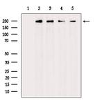 Phospho-EIF4G1 (Ser1147) Polyclonal Antibody