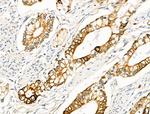Phospho-FOXO3A (Ser413) Antibody in Immunohistochemistry (Paraffin) (IHC (P))