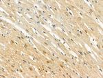 Phospho-FOXO3A (Ser413) Antibody in Immunohistochemistry (Paraffin) (IHC (P))
