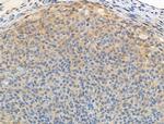 Phospho-FOXO3A (Ser413) Antibody in Immunohistochemistry (Paraffin) (IHC (P))