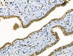 Phospho-FOXO3A (Ser7) Polyclonal Antibody