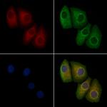 Phospho-ErbB2 (HER-2) (Tyr1196) Antibody in Immunocytochemistry (ICC/IF)