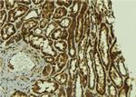 Phospho-ErbB2 (HER-2) (Tyr1221, Tyr1222) Antibody in Immunohistochemistry (Paraffin) (IHC (P))