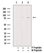 Phospho-HSL (Ser853) Polyclonal Antibody