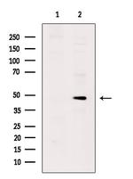 Phospho-Cytokeratin 17 (Ser44) Antibody in Western Blot (WB)