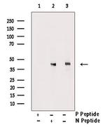 Phospho-LAT (Tyr200) Polyclonal Antibody