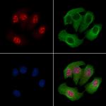 Phospho-MAPKAPK2 (Thr222) Antibody in Immunocytochemistry (ICC/IF)