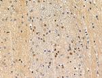 Phospho-MEF2A (Ser408) Polyclonal Antibody