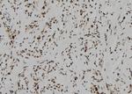 Phospho-MEF2A (Ser408) Antibody in Immunohistochemistry (Paraffin) (IHC (P))