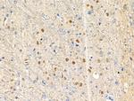 Phospho-NPM1 (Thr95) Polyclonal Antibody