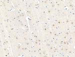 Phospho-NPM1 (Thr95) Antibody in Immunohistochemistry (Paraffin) (IHC (P))