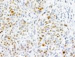 Phospho-NuMA (Thr2055) Antibody in Immunohistochemistry (Paraffin) (IHC (P))