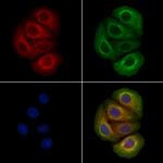 Phospho-p130Cas (Tyr249) Antibody in Immunocytochemistry (ICC/IF)
