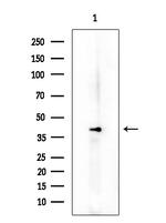 Phospho-NCF4 (Thr154) Polyclonal Antibody
