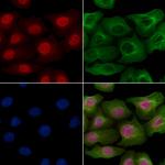 Phospho-p53 (Thr18) Polyclonal Antibody