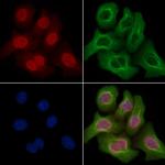 Phospho-p53 (Thr81) Antibody in Immunocytochemistry (ICC/IF)