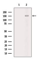 Phospho-PTPRA (Tyr798) Antibody in Western Blot (WB)