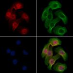 Phospho-Rb (Ser608) Polyclonal Antibody