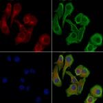 Phospho-RIP1 (Ser166) Polyclonal Antibody