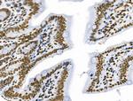 Phospho-SF3B1 (Thr313) Antibody in Immunohistochemistry (Paraffin) (IHC (P))