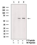 Phospho-SGK3 (Thr320) Polyclonal Antibody