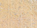 Phospho-SHIP2 (Tyr1135) Antibody in Immunohistochemistry (Paraffin) (IHC (P))
