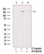 Phospho-SHIP2 (Tyr986, Tyr987) Antibody in Western Blot (WB)