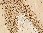 Phospho-SRC3 (Thr24) Antibody in Immunohistochemistry (Paraffin) (IHC (P))