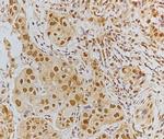 Phospho-Tau (Ser519) Antibody in Immunohistochemistry (Paraffin) (IHC (P))