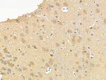 Phospho-Tau (Ser733) Antibody in Immunohistochemistry (Paraffin) (IHC (P))