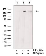 Phospho-TBC1D1 (Ser237) Antibody in Western Blot (WB)