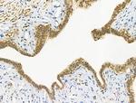 Phospho-TBC1D1 (Ser237) Polyclonal Antibody