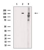 Phospho-TEK (Tyr992) Polyclonal Antibody