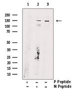 Phospho-ULK1 (Ser467) Polyclonal Antibody