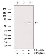 Phospho-Vimentin (Ser83) Antibody in Western Blot (WB)
