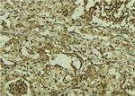 Phospho-CDK6 (Tyr13) Antibody in Immunohistochemistry (Paraffin) (IHC (P))