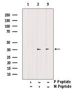 Phospho-CDK6 (Tyr13) Antibody in Western Blot (WB)