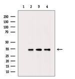 Phospho-CDK6 (Tyr292) Polyclonal Antibody
