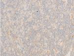 Phospho-IkappaB epsilon (Ser161) Polyclonal Antibody