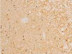 Phospho-IkappaB epsilon (Ser161) Antibody in Immunohistochemistry (Paraffin) (IHC (P))